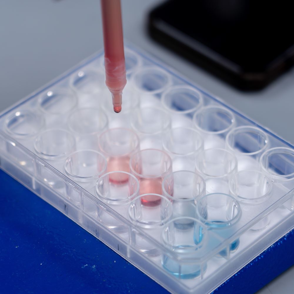Lab samples being tested.