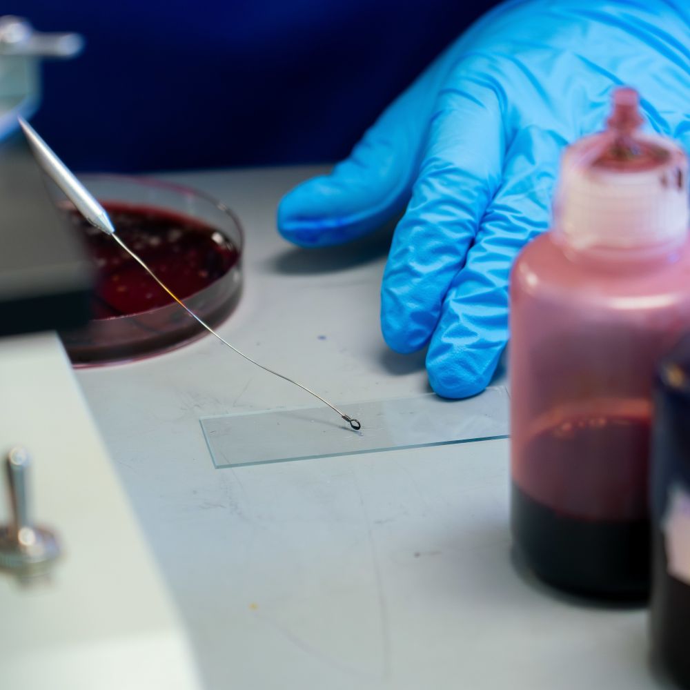A student putting a substance on a slide.